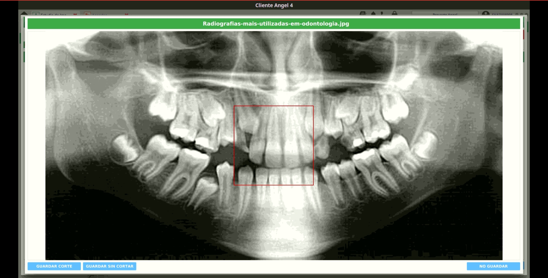 corte de imagen