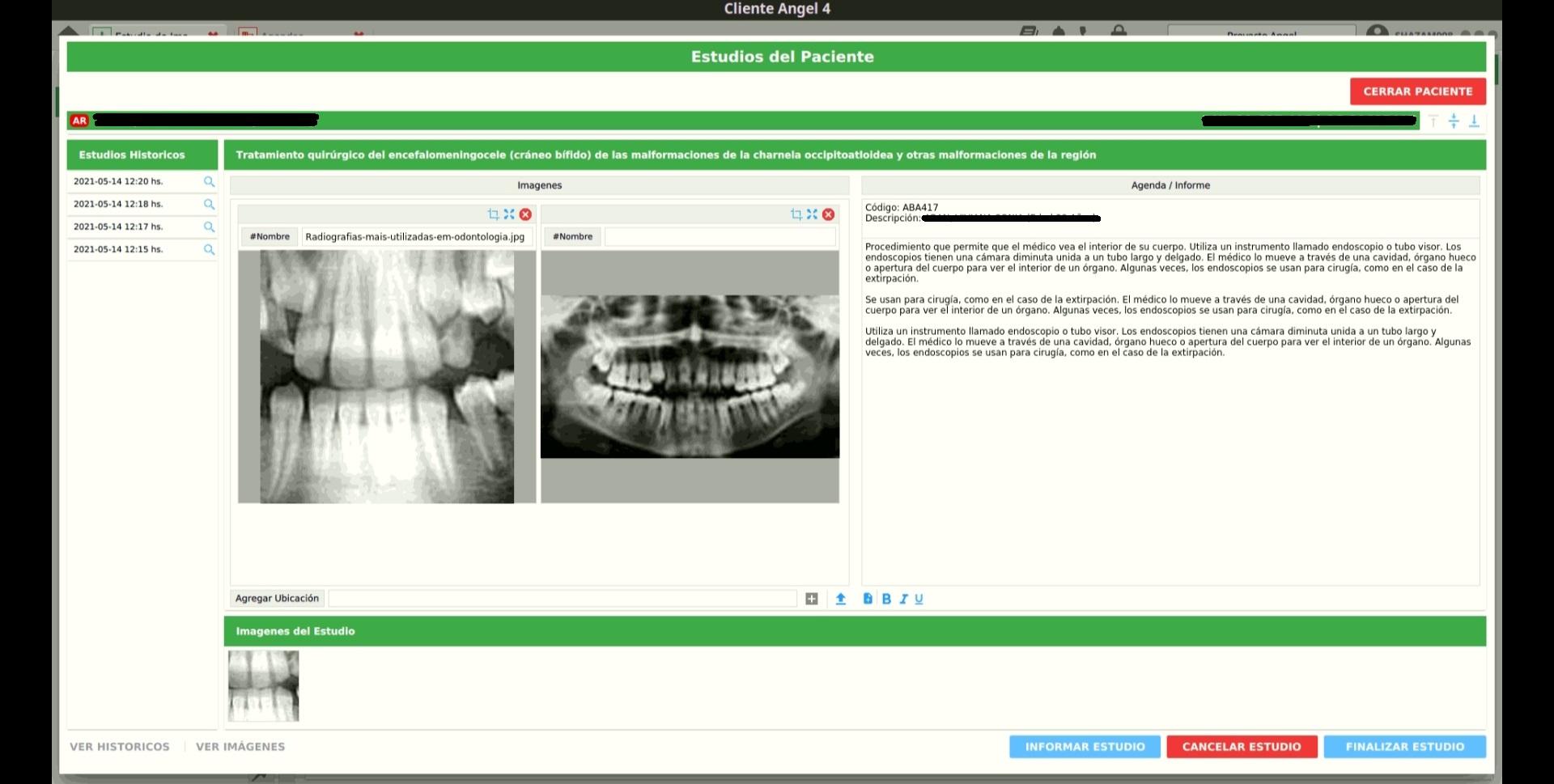 agregar imagenes borradas