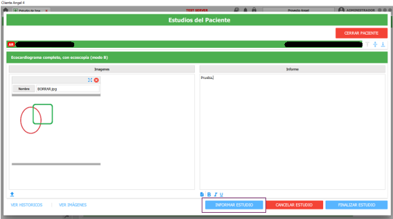informar estudio