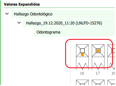 union de hallazgos