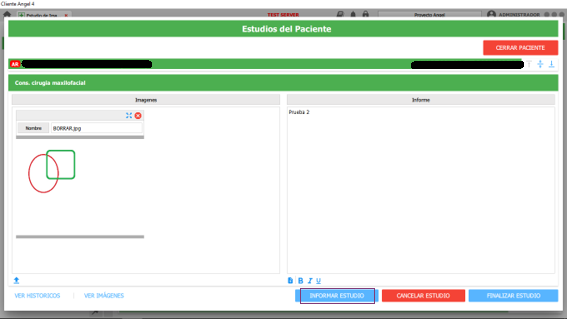 informar estudio
