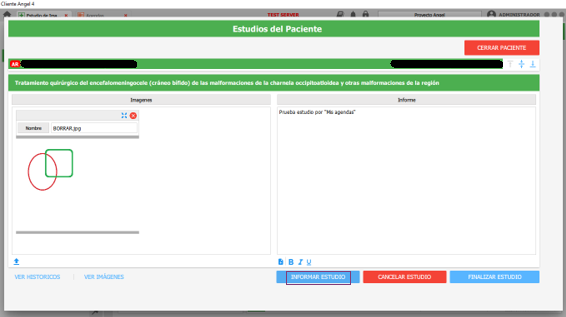 informar estudio